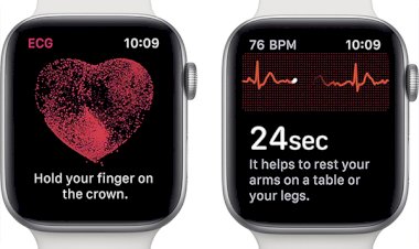 Tính năng ECG trên Apple watch giúp phát hiện tình trạng thiếu máu tim cục bộ mà bệnh viện không thể phát hiện.