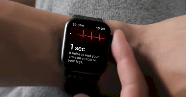 Hướng dẫn kích hoạt ECG trên Apple Watch tại Việt Nam